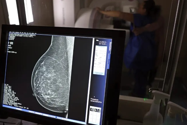 Brasil tem desigualdade no acesso à mamografia, aponta relatório