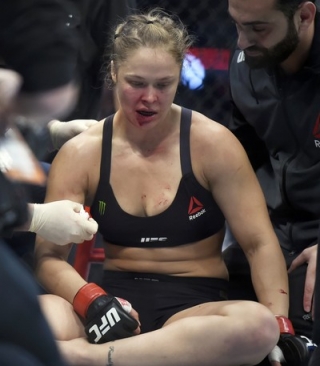 Ronda Rousey apÃ³s derrota no UFC 193 (Foto: Andy Brownbill / AP)