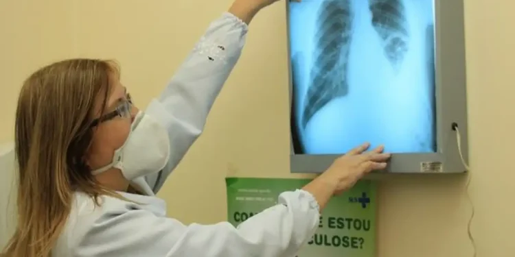OMS alerta para avanço da tuberculose e cobra diagnóstico mais rápido