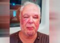 “Seu petista de merda”: Idoso denuncia agressão com suposta motivação política em Copacabana