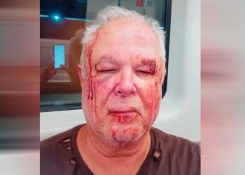 “Seu petista de merda”: Idoso denuncia agressão com suposta motivação política em Copacabana