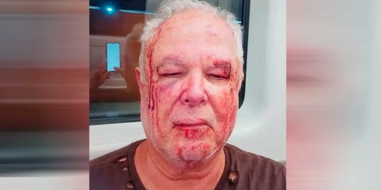 “Seu petista de merda”: Idoso denuncia agressão com suposta motivação política em Copacabana
