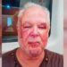 “Seu petista de merda”: Idoso denuncia agressão com suposta motivação política em Copacabana