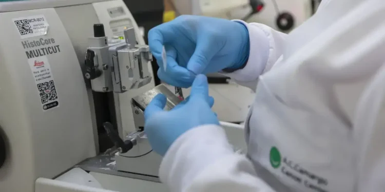SUS vai oferecer nova terapia para pacientes com leucemia mieloide aguda