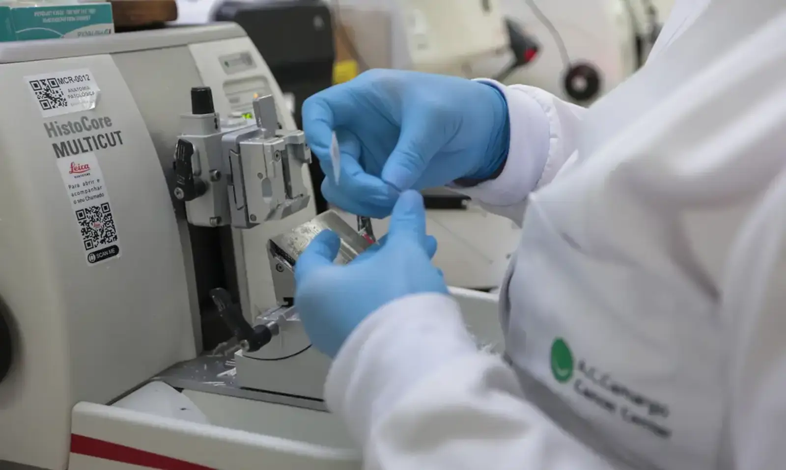 SUS vai oferecer nova terapia para pacientes com leucemia mieloide aguda